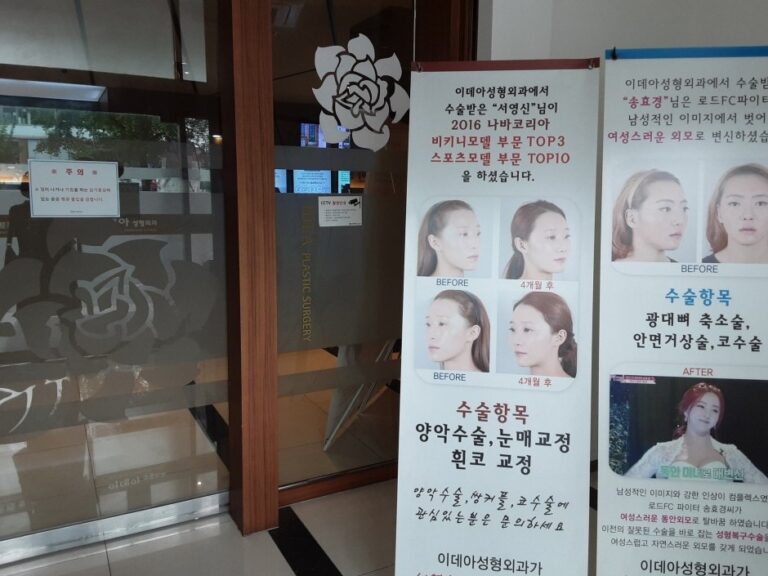 [Seoul] IDEA Plastic Surgical Clinic [Tax Refund Shop] (이데아성형외과 [사후면세점])